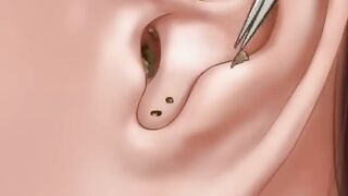 Ear cleaning ASMR# للعناية بالبشرة ASMR Animation #