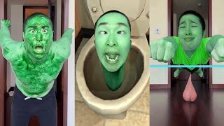 CRAZIEST Sagawa1gou Funny TikTok Compilation | Try Not To Laugh Watching Cactus Dance Challenge 2023 29