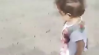 كلب يأكل طفلة امام والديها A dog eats a little girl in front of her parents