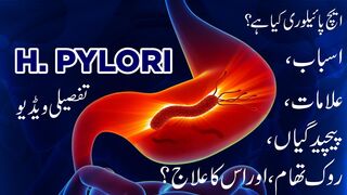 Helicobacter pylori | Causes, Symptoms, Prevention, Diagnosis, and Treatment | Urdu/Hindi