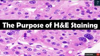 H&E Staining | Purpose of staining in histopathology | Human Touch in H&E Staining