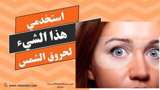 حروق الشمس | وصفات لعلاج حروق الشمس