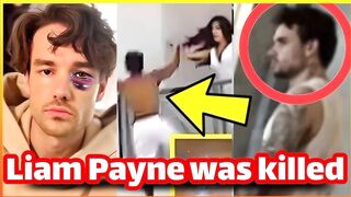 The moment Liam Payne was killed and a video was leaked of Liam Payne with his eye swollen a scandal