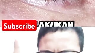 Aku reaction video Jangan pernah mencabut bulu mata karena itu sangat berbahaya