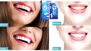 14pcs/box 9D Teeth Whitening Strips