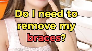 Do i need to remove my braces?