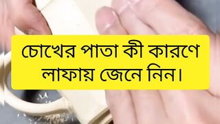 চোখের পাতা কী কারণে লাফায় জেনে নিন।