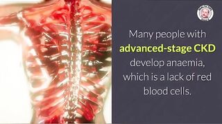 Anemia and Kidney Disease_ What You Should Know!