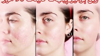 Skin Care Homeopathic Treatment ✨????